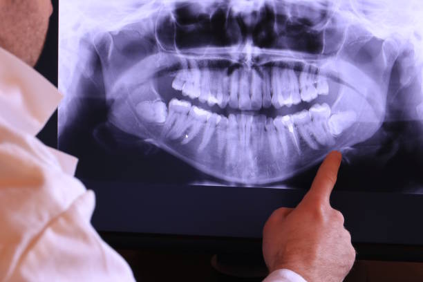 Best Emergency Treatment for Dental Infections or Abscesses in Mansfield, OH