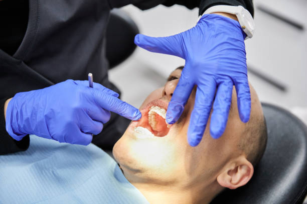 Best Urgent Care for Lost Fillings or Crowns in Mansfield, OH
